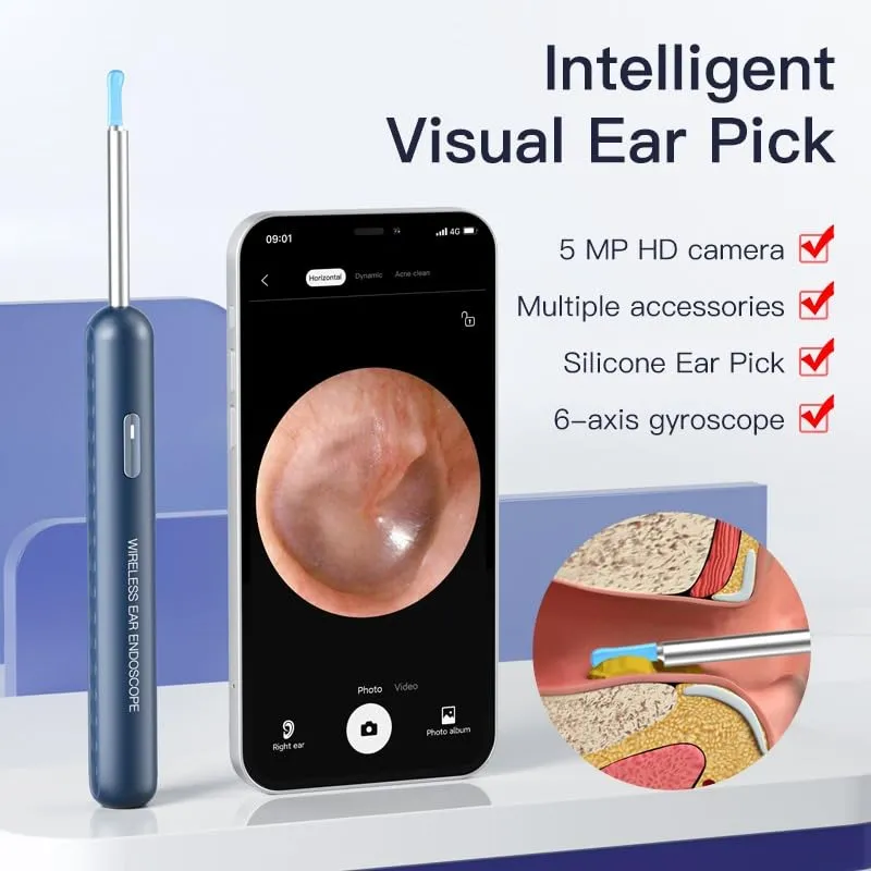 Smart pro ear endoscope ear cleaner tool Ear Inspectionl endoscope camera 4.3mm lens For Ear's best Health